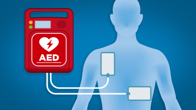Automated External Defibrillator graphic